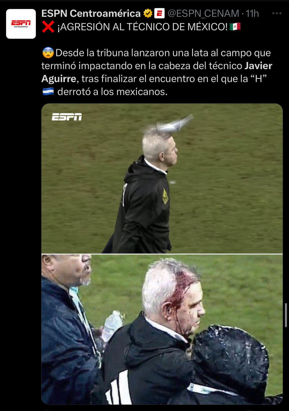 “Acto criminal” “vergonzoso” “aficionado idio**”: la fuerte reacción de la prensa a la agresión de Javier Aguirre