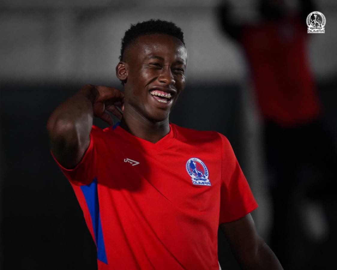 Olimpia con 9 bajas para partido en Liga Nacional: Así sería el improvisado 11 titular de Espinel, con delantera inédita