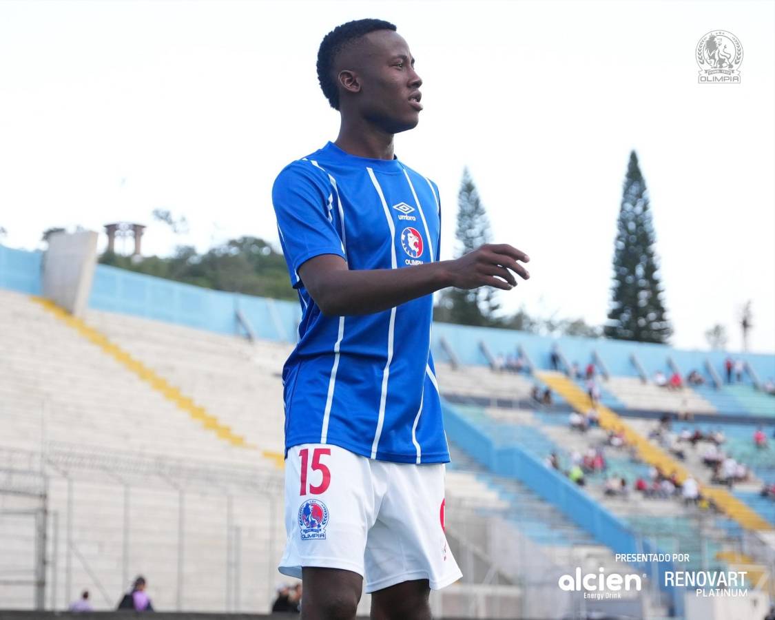 ¡Un mediocampo inesperado! Olimpia expone su invicto con 5 bajas contra Marathón, así se perfila su 11 titular