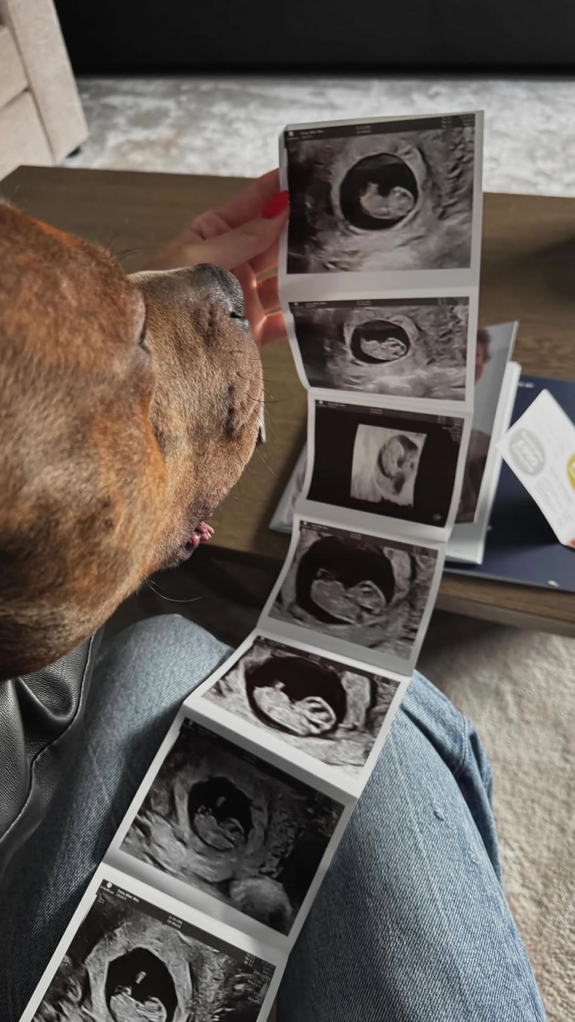 Embarazó a la mejor amiga de su ex novia y así reaccionó: el polémico triángulo amoroso de compañero de Messi