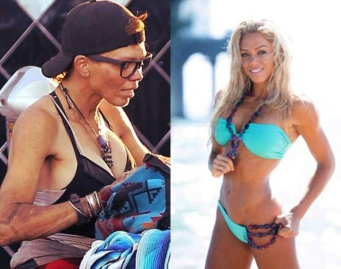 De Hollywood a la calle: el drama de una famosa modelo que ahora come basura y luce irreconocible