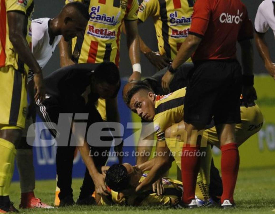 El drama del zaguero Allans Vargas que dio el susto en el Real España