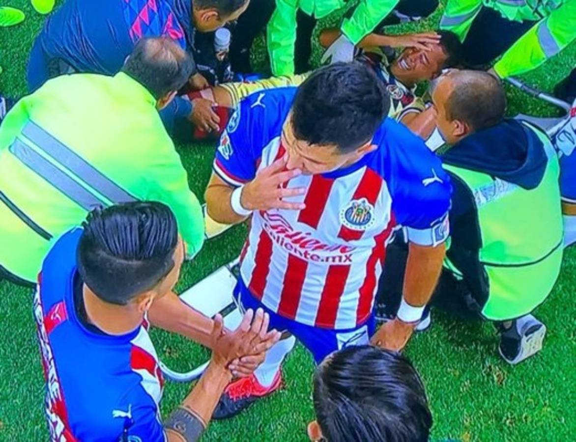 Las impactantes y terroríficas imágenes de la grave lesión de Giovanni dos Santos