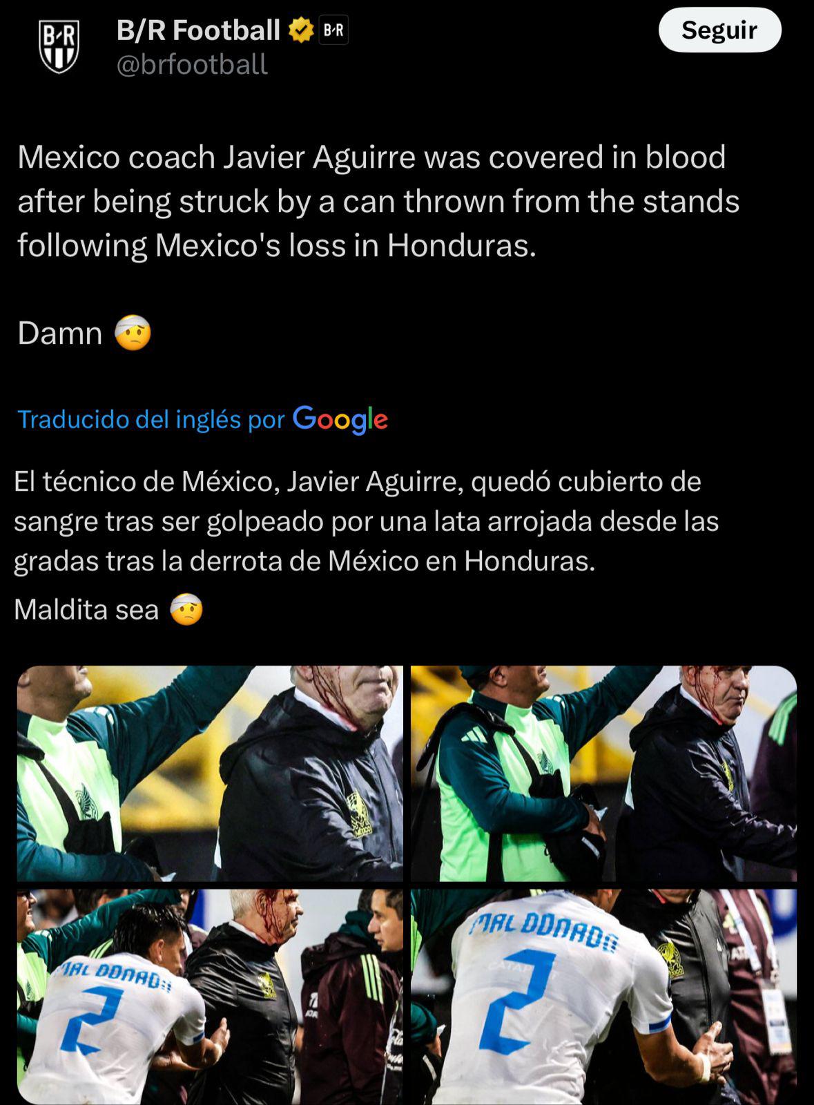 “Acto criminal” “vergonzoso” “aficionado idio**”: la fuerte reacción de la prensa a la agresión de Javier Aguirre