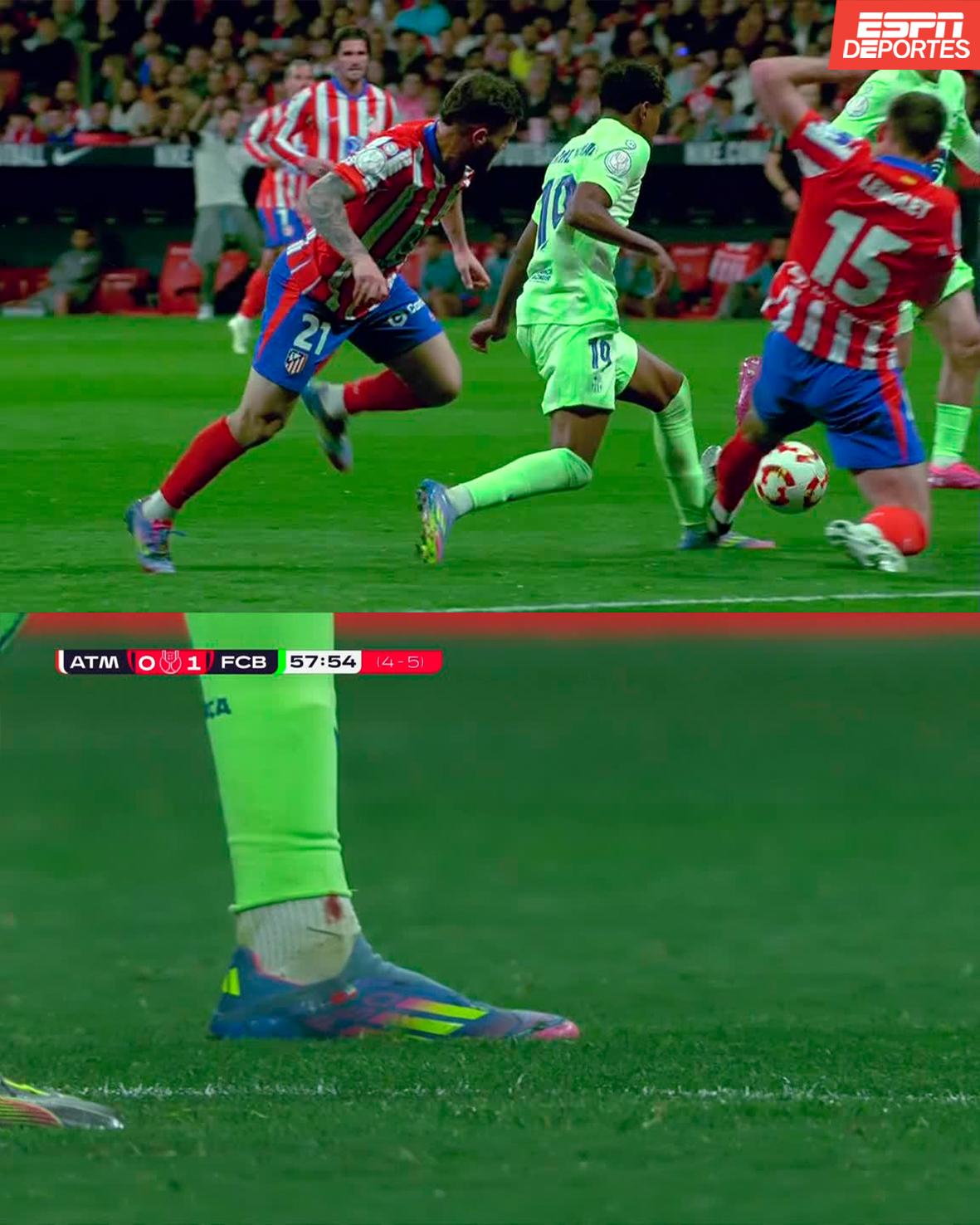 Lamine Yamal acabó con sangre, patadas del Atlético y la cábala que le falló a Simeone; Szczesny sigue invicto