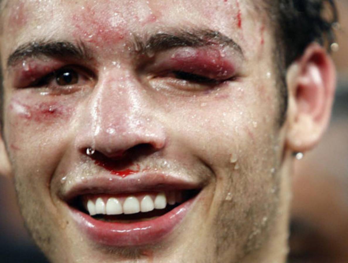 Las mejores imágenes de la pelea Chávez JR. vs Maravilla Martínez.