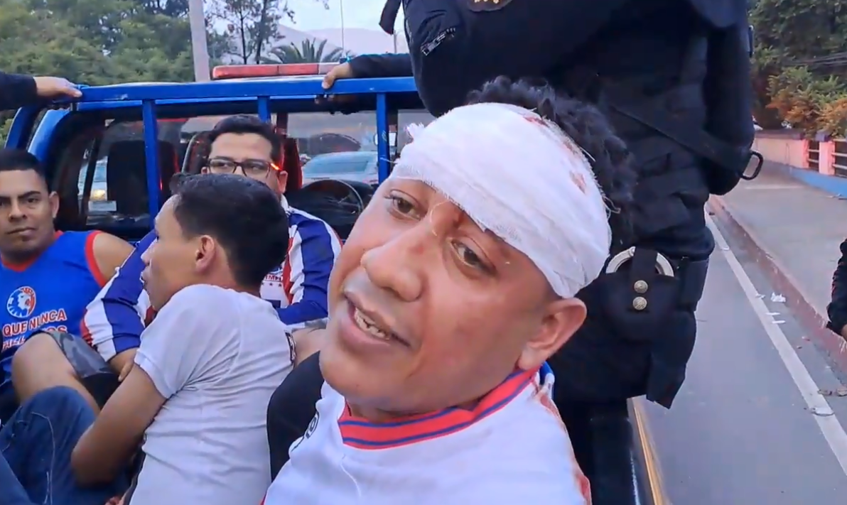 Fotos: Zafarrancho, gas lacrimógeno y los hondureños que fueron capturados por los fuertes disturbios entre barras de Municipal y Olimpia