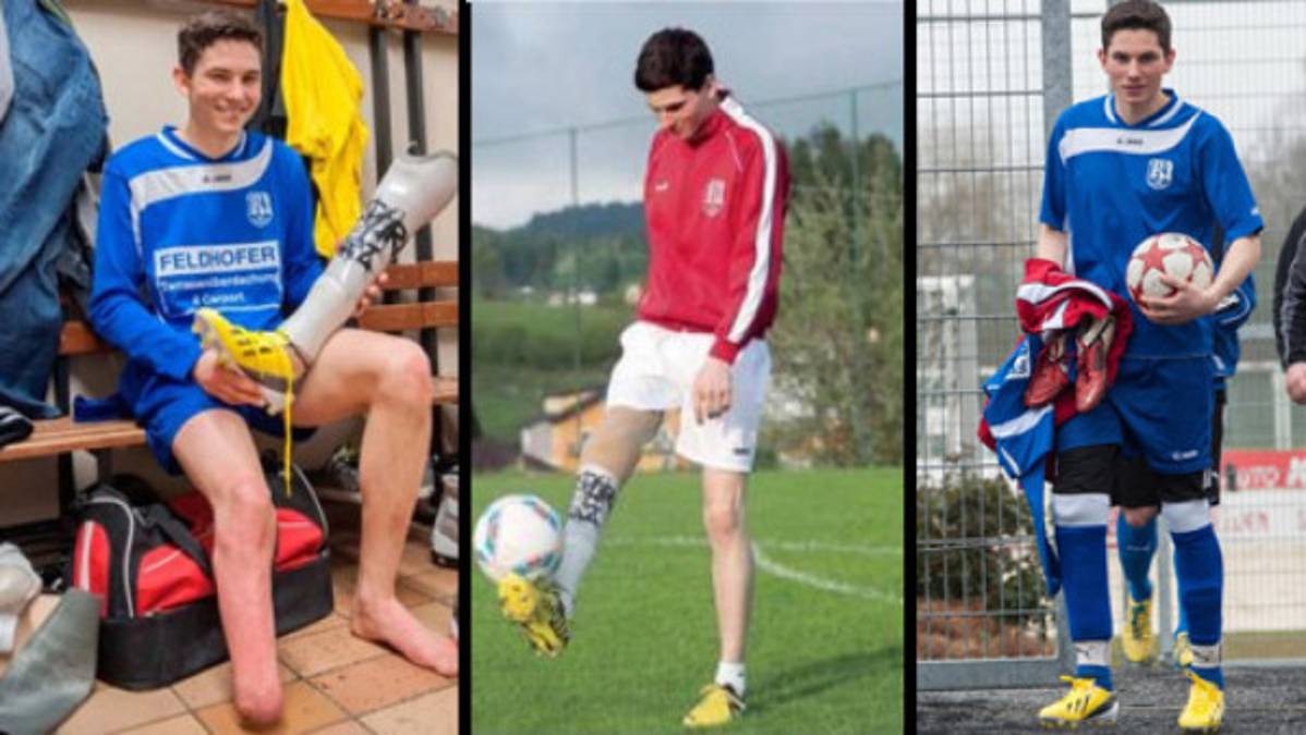 FIFA autoriza a futbolista amputado a jugar con prótesis