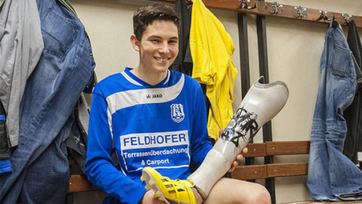 FIFA autoriza a futbolista amputado a jugar con prótesis