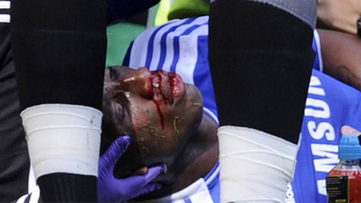 La escalofriante caída de Didier Drogba