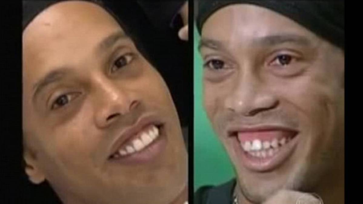 VIDEO: Ronaldinho estrena sonrisa de Hollywood