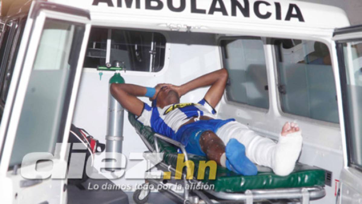 Panameño Mosquera, fracturado de tibia y peroné