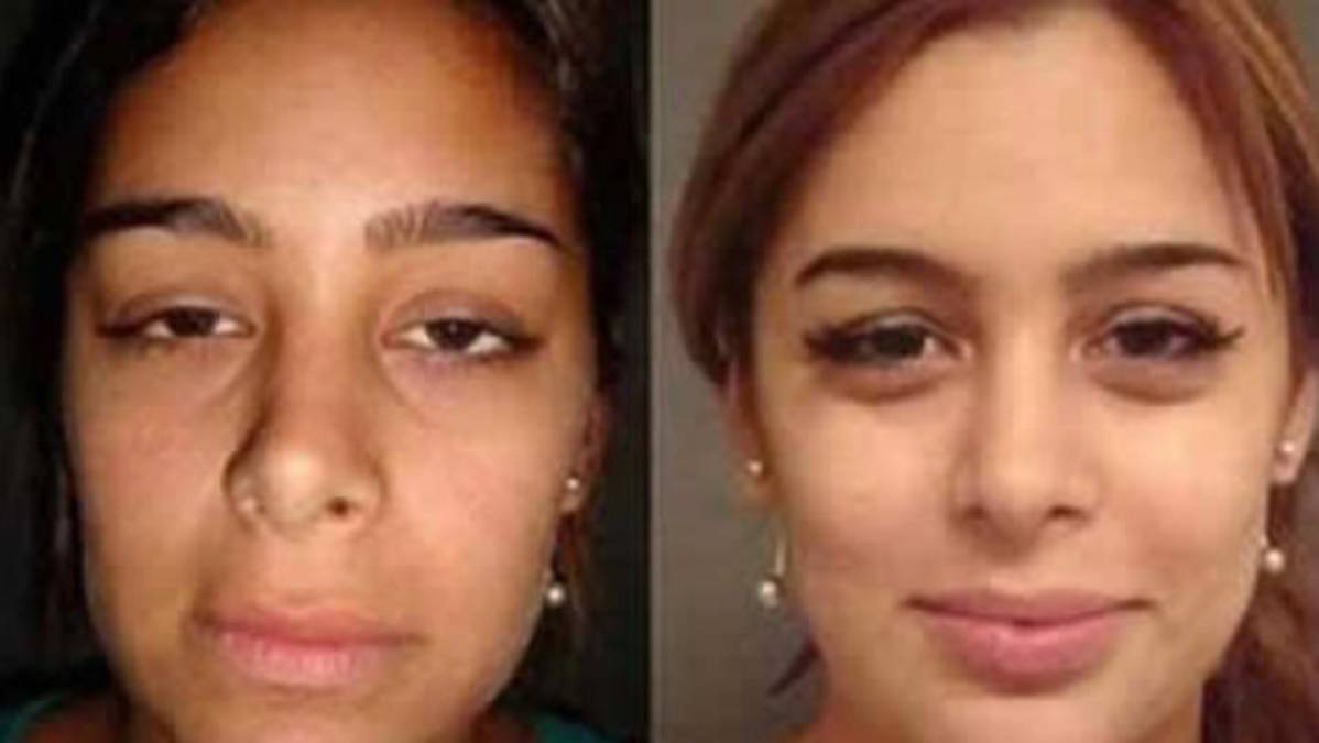 Larissa: antes y después del bisturí