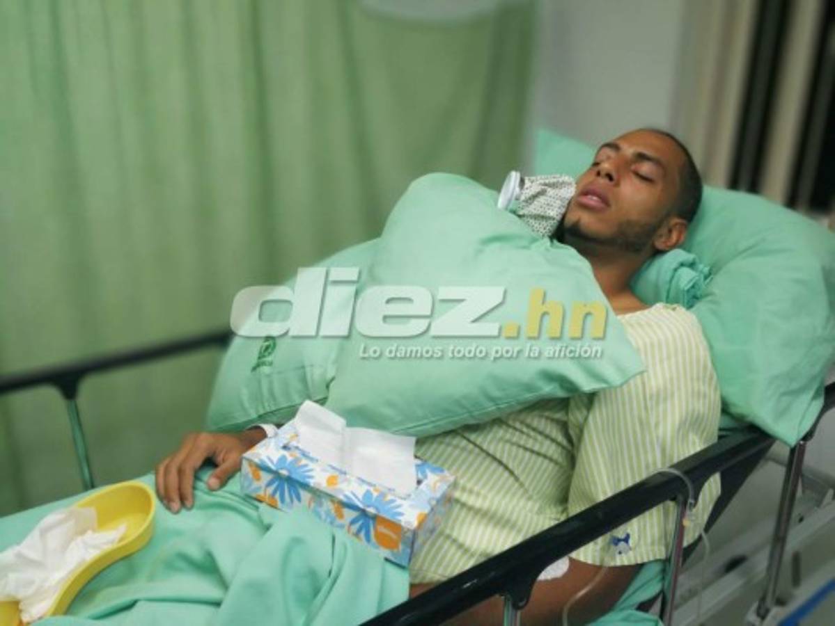 FOTOS: Así le quedó el rostro a Eddie Hernández tras el terrible golpe