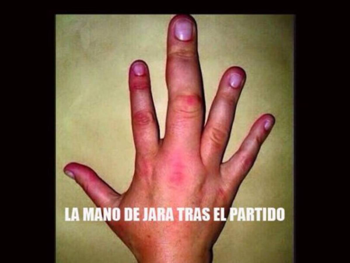 Los memes que dejó el dedazo de Jara a Cavani en el Chile-Uruguay