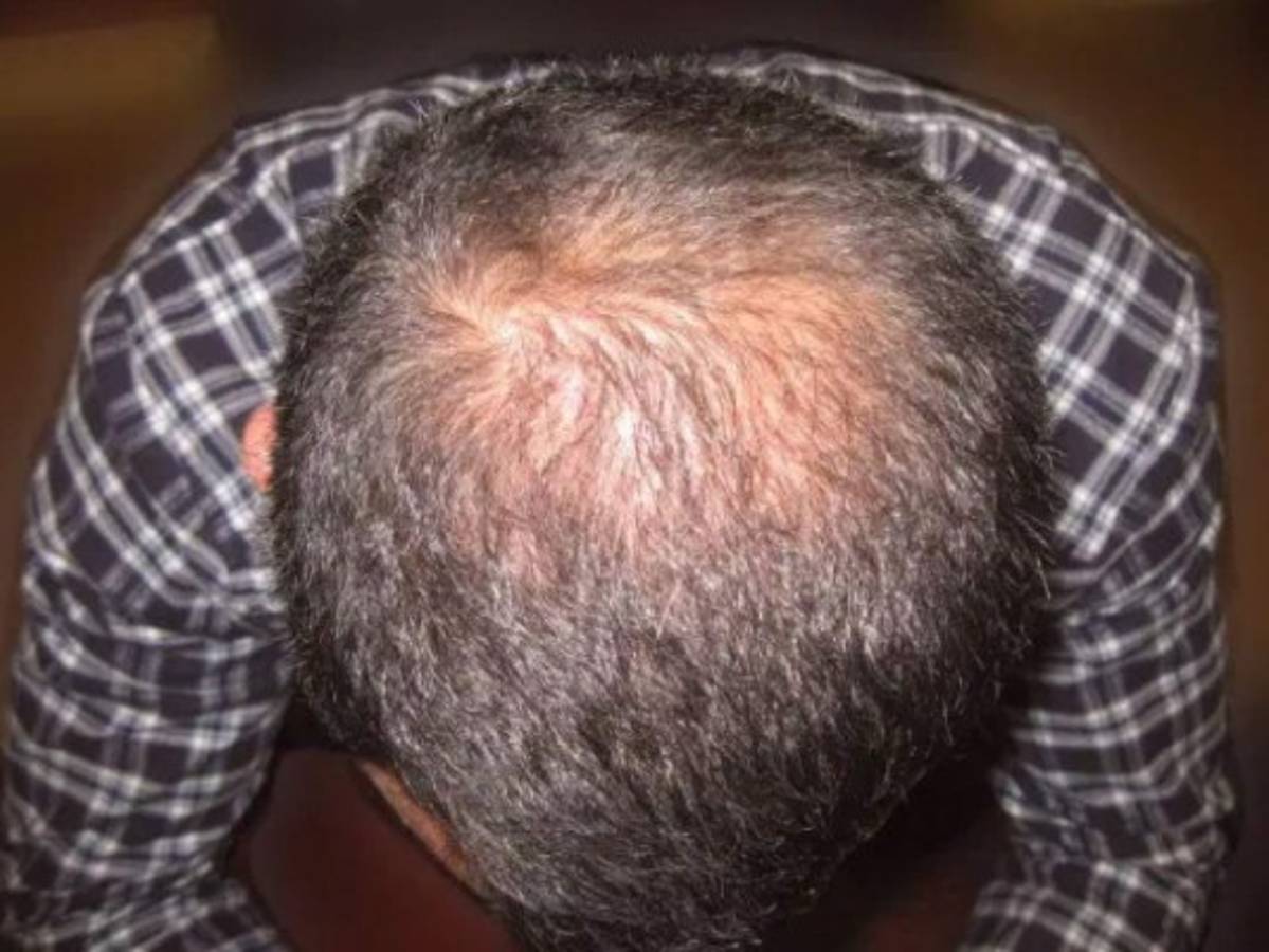 El trauma que sufrió Ryan Giggs por alcanzar la fama con el Manchester United