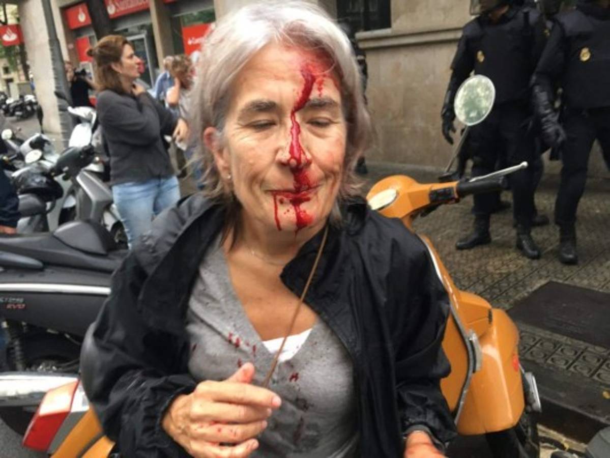 ¡Decenas de heridos! Las imágenes del choque de policía con catalanes a favor de independencia