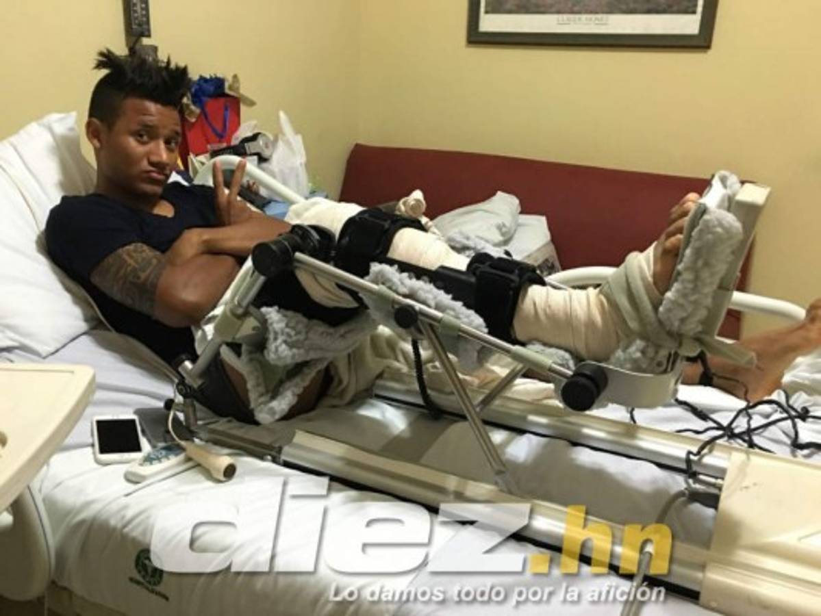 Así se recuperó Garrido de la lesión por la que le hubiesen cortado la pierna