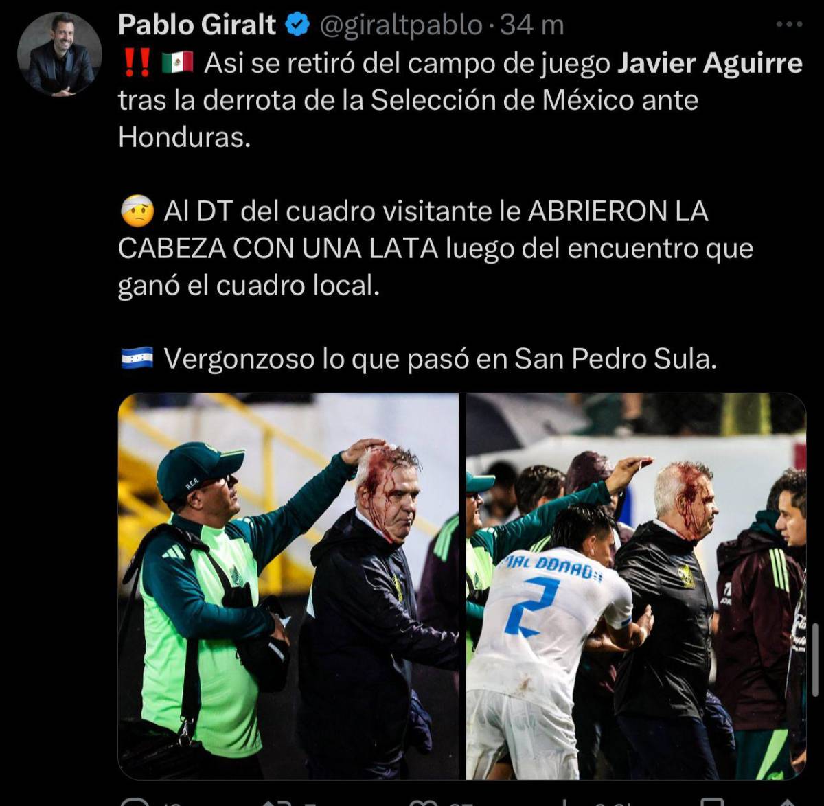 “Acto criminal” “vergonzoso” “aficionado idio**”: la fuerte reacción de la prensa a la agresión de Javier Aguirre