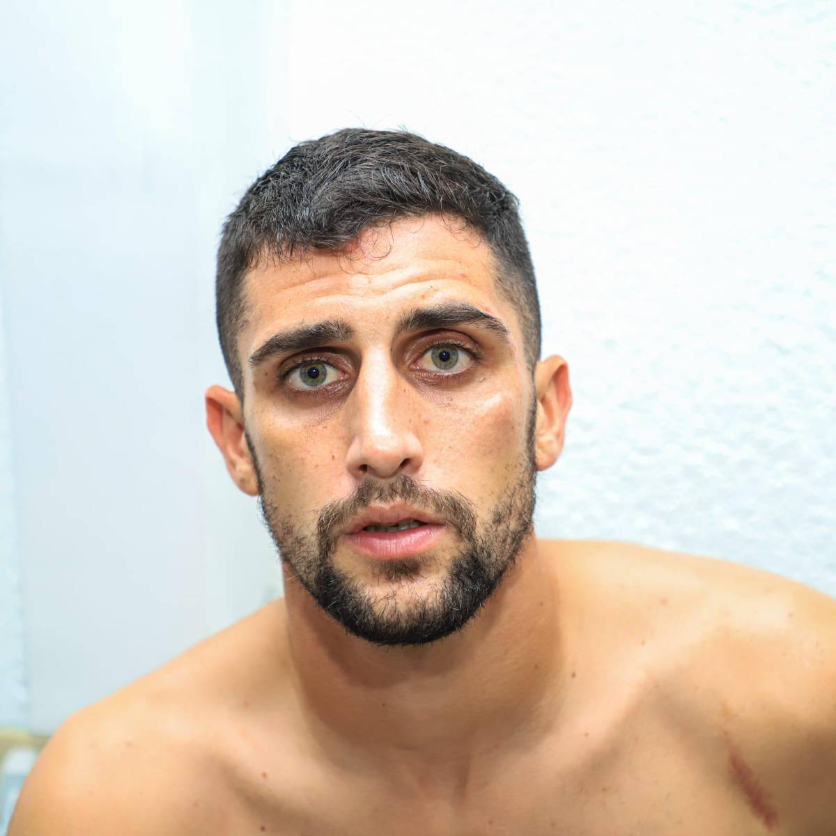 Las fotos que dejó el zafarrancho en el Olancho - Marathón: tendidos en el suelo, golpes en la cara y bruscos agarrones