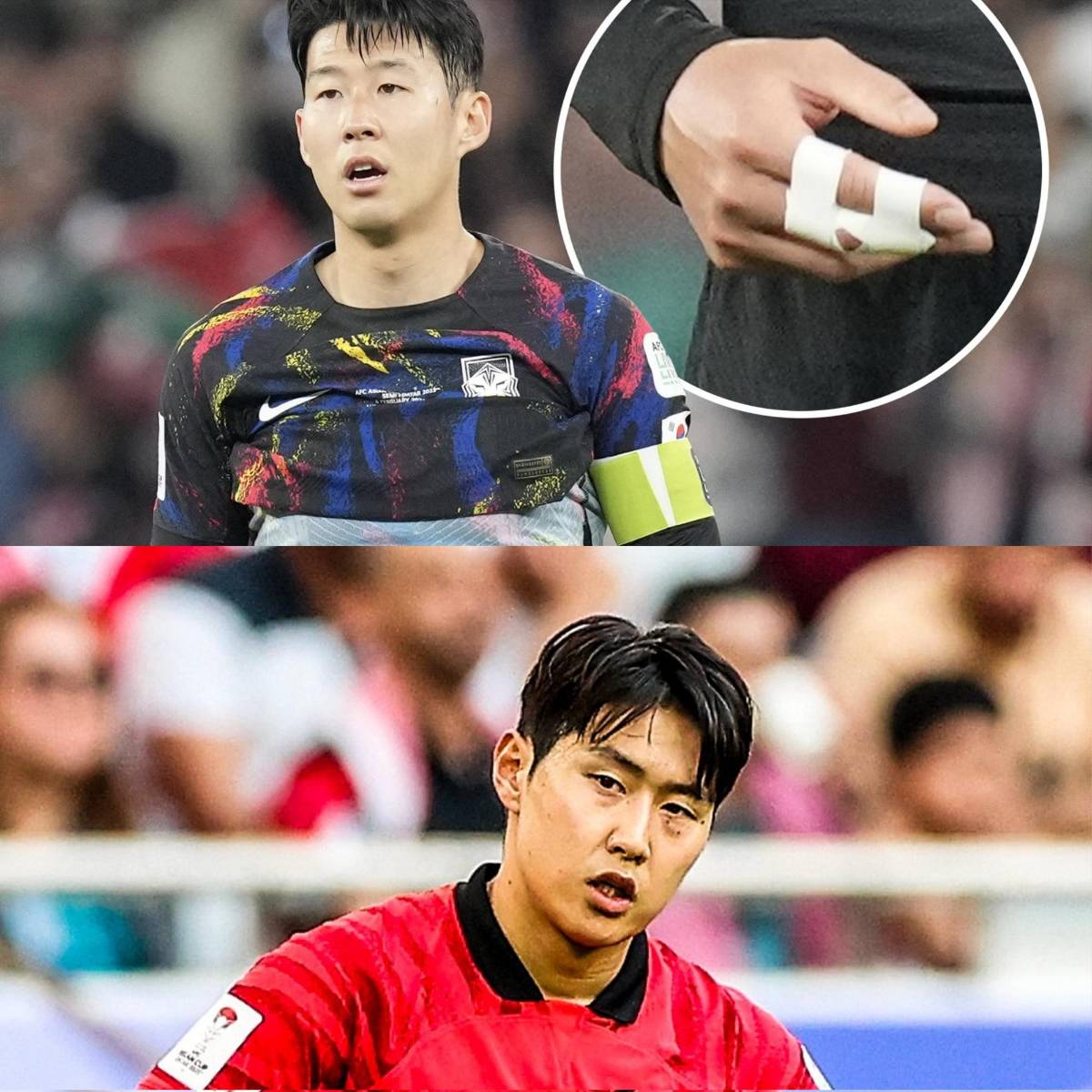 Son Heung-Min sale herido tras una pelea y revelan el insólito motivo del altercado: Así quedó su mano