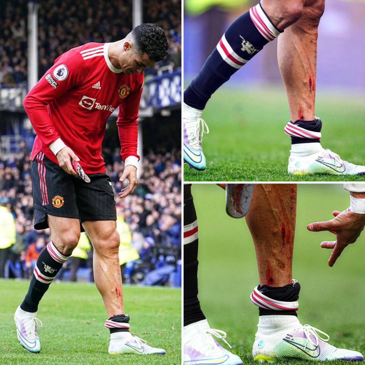 Escalofriante: así le quedó la pierna a Cristiano Ronaldo en la dolorosa derrota del Manchester United