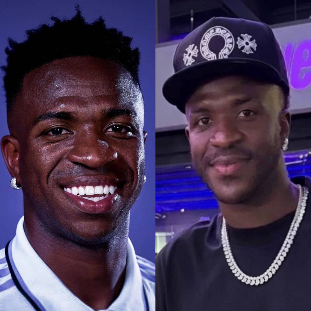 Vinicius pasa por el quirófano y sorprende a todos con su nuevo rostro tras el Mundial