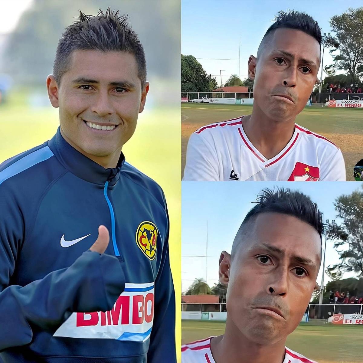 Fue campeón en México y revela la rara enfermedad que deterioró su rostro: Me diagnosticaron...