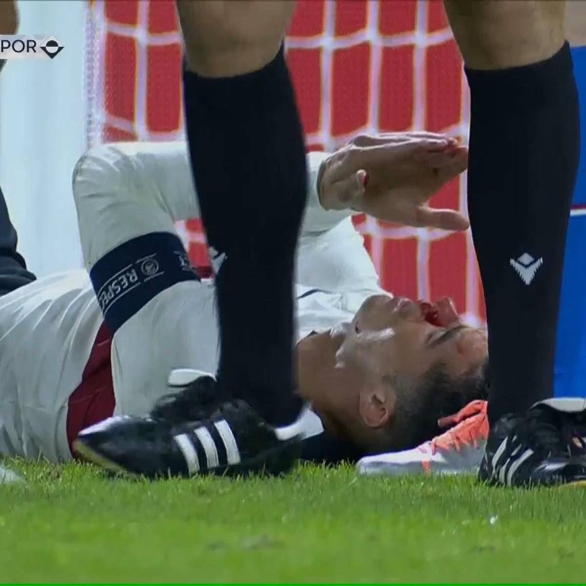 Los checos le dieron con todo: Cristiano Ronaldo sufre durísimo golpe que lo dejó tendido en el suelo y sangrando