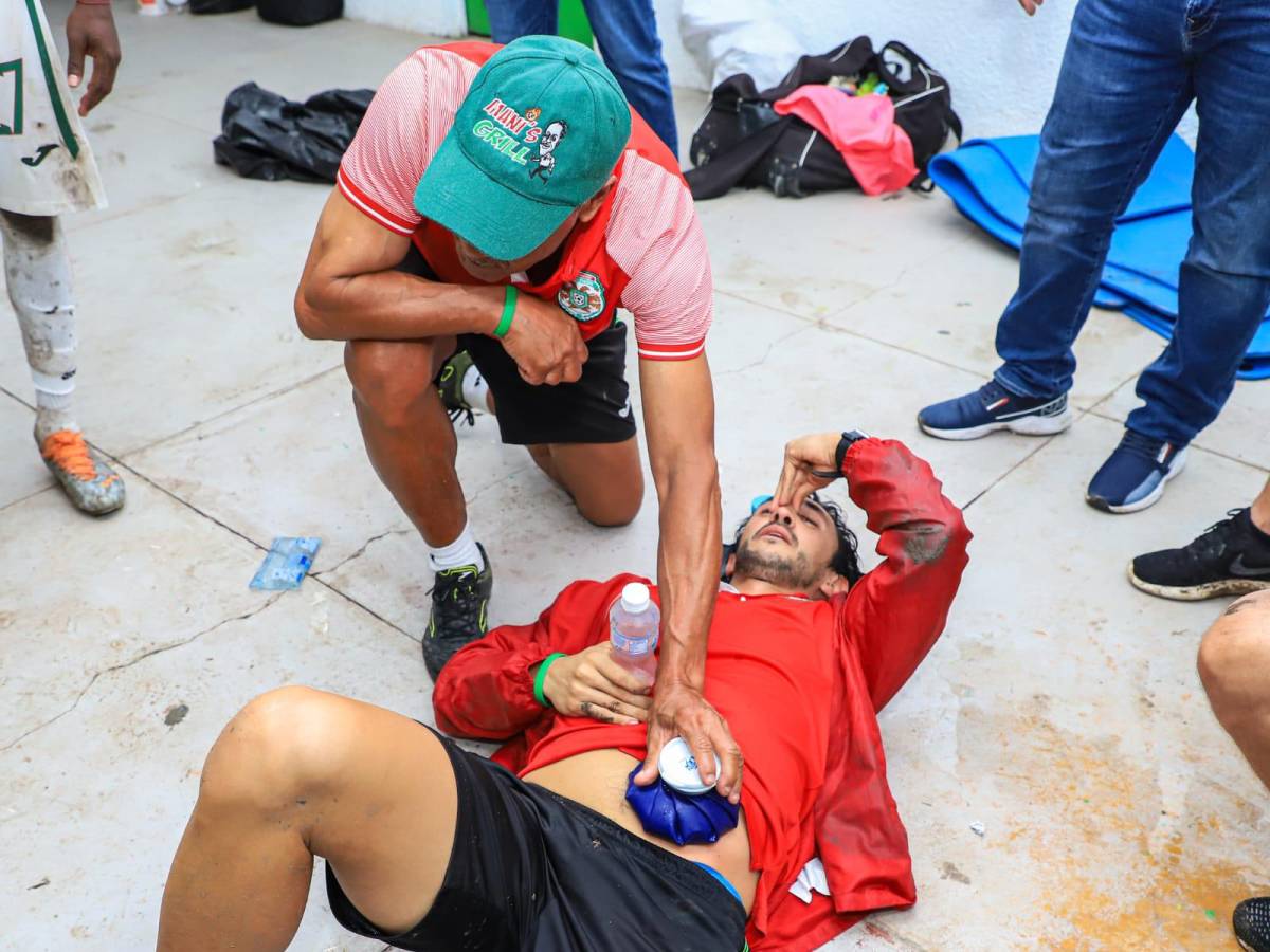 Las fotos que dejó el zafarrancho en el Olancho - Marathón: tendidos en el suelo, golpes en la cara y bruscos agarrones