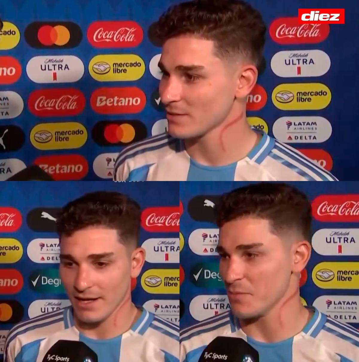 El gesto de Messi con Alphonso Davies y la marca de Julián Álvarez en su cuello; el “beso de la suerte” para la Copa América