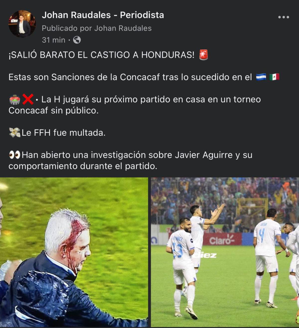 “Salió barato”: la reacción de la prensa hondureña y mexicana al castigo que recibió la ‘H’ tras lo acontecido con Javier Aguirre