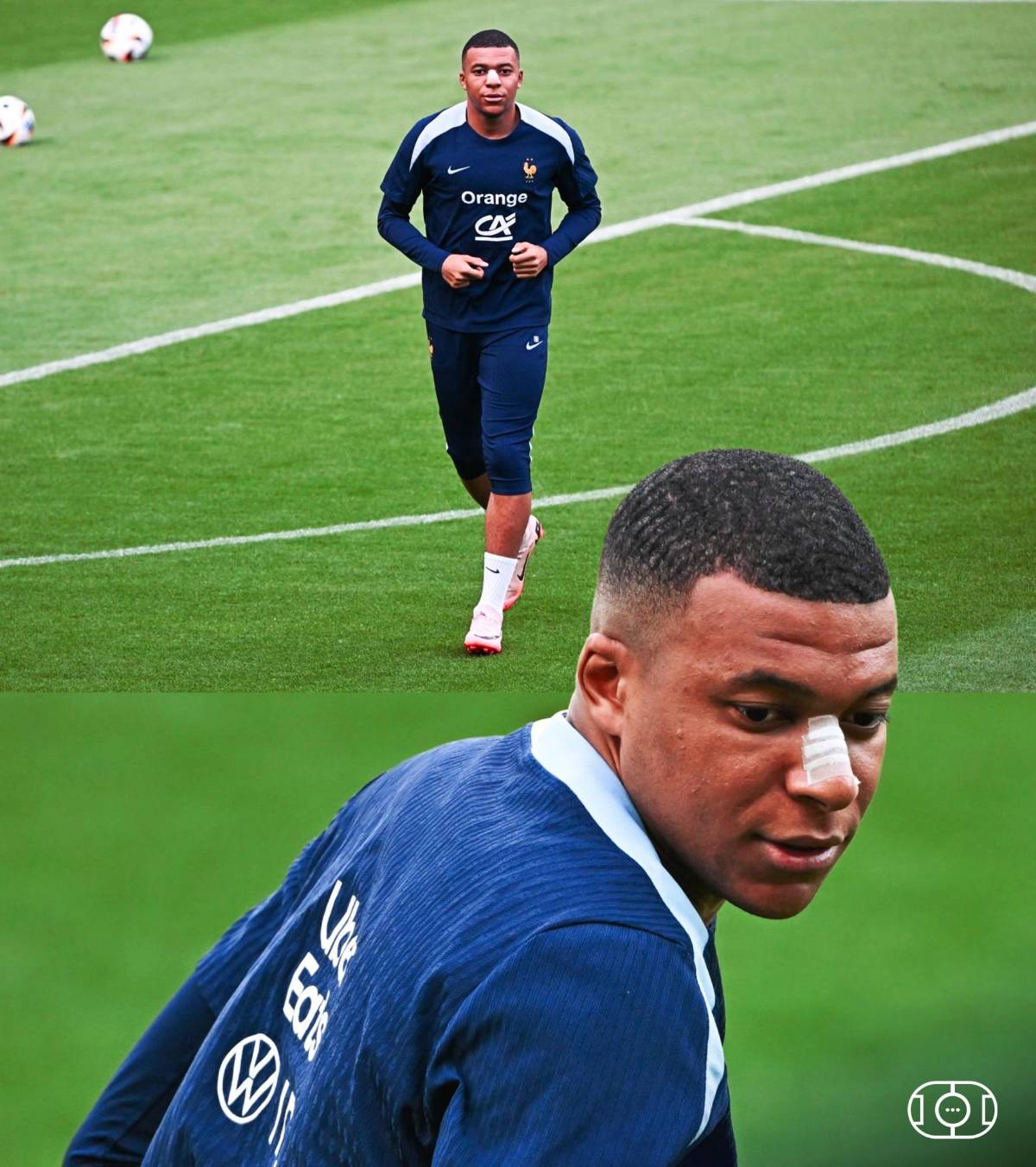 Las primeras fotos de Kylian Mbappé tras fracturarse la nariz en la Eurocopa 2024: el anuncio de su entrenador