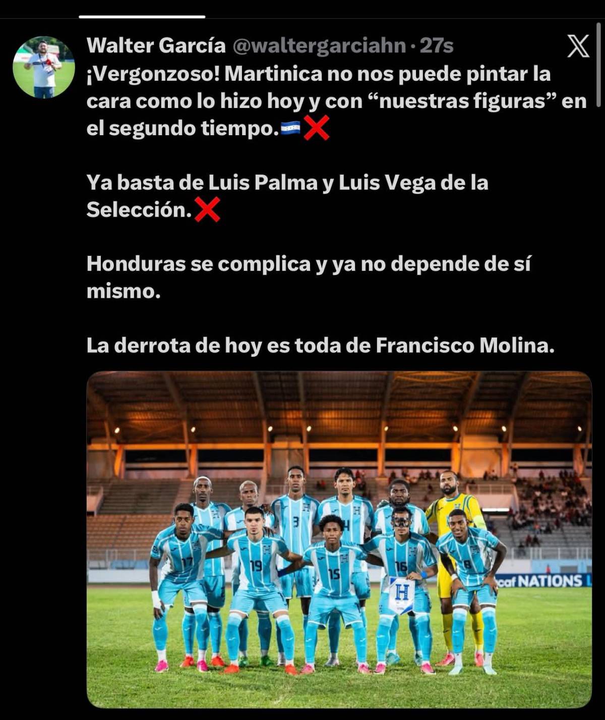Tengan vergüenza: así reacciona la prensa tras el fracaso de Honduras