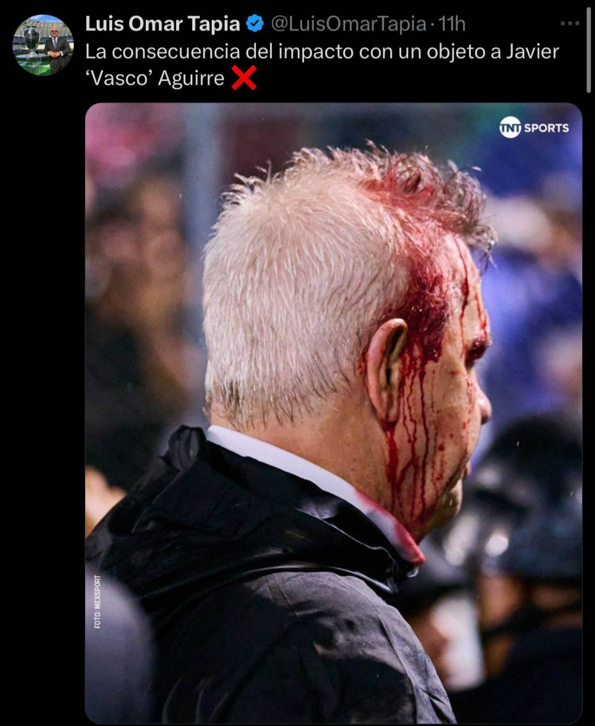 “Acto criminal” “vergonzoso” “aficionado idio**”: la fuerte reacción de la prensa a la agresión de Javier Aguirre