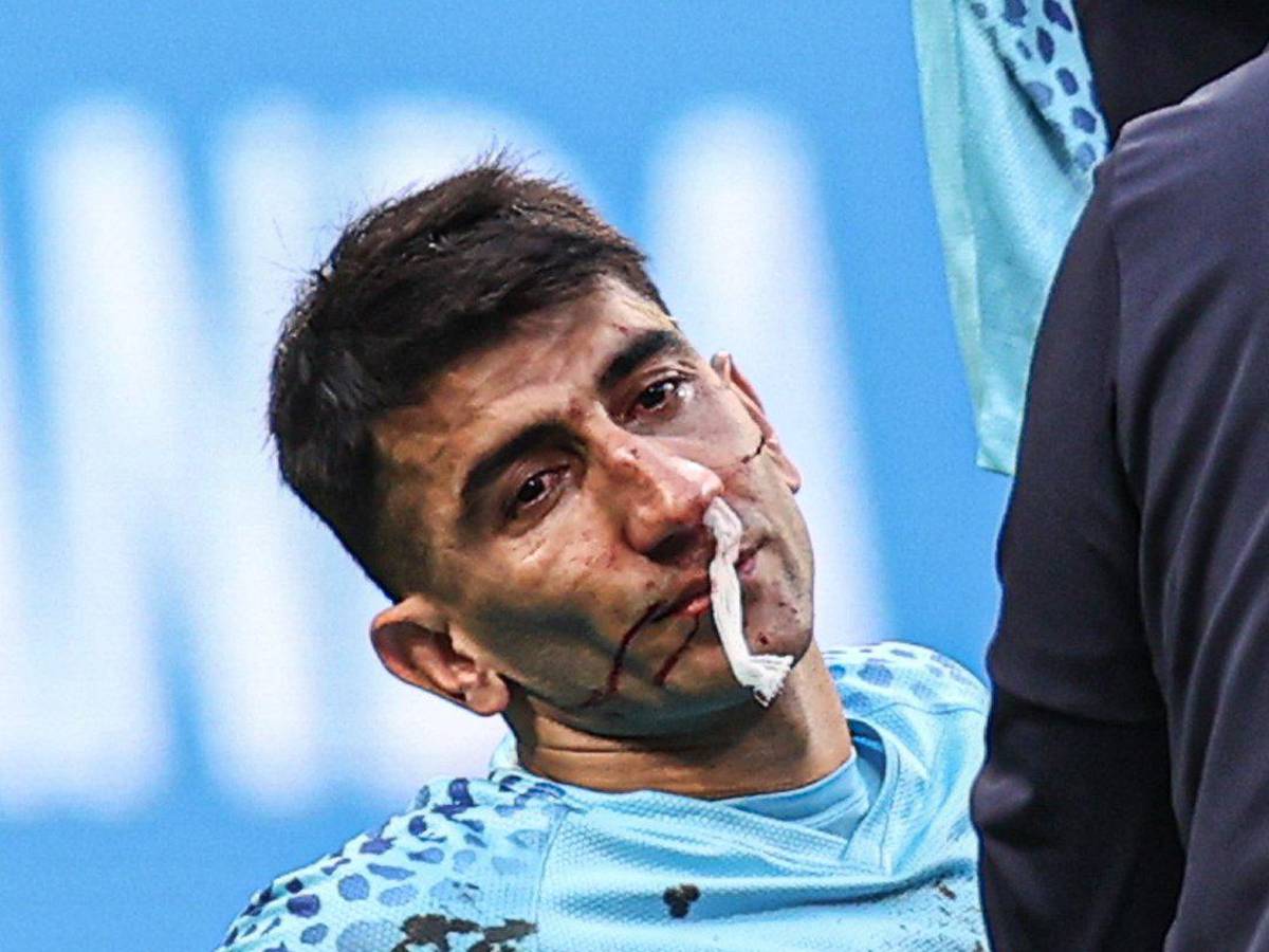 FOTOS: Portero de Irán se fue en camilla luego de recibir terrible golpe de su propio compañero en el Mundial de Qatar 2022
