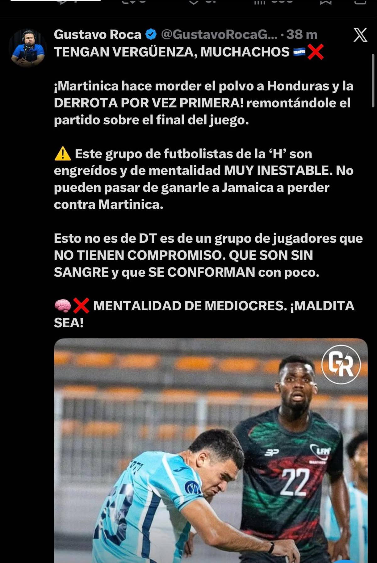 Tengan vergüenza: así reacciona la prensa tras el fracaso de Honduras