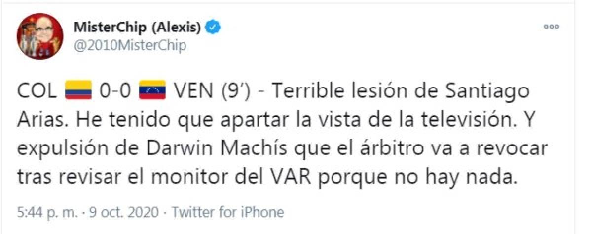 Dolorosas imágenes: así quedó el tobillo de Santiago Arias tras sufrir terrible lesión en el Colombia-Venezuela