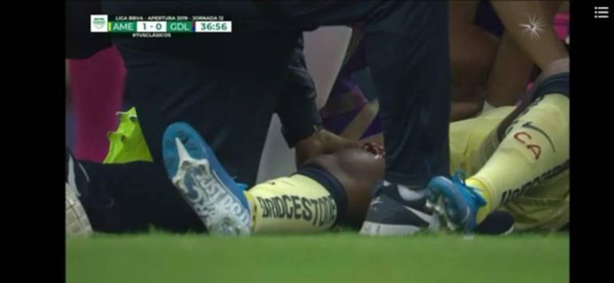 Las impactantes y terroríficas imágenes de la grave lesión de Giovanni dos Santos