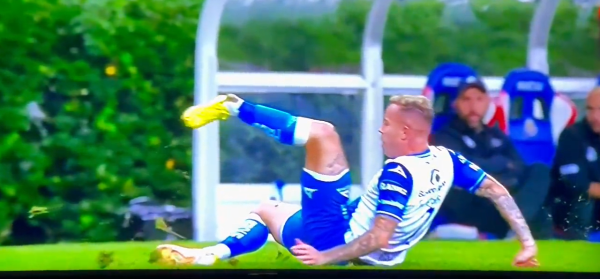 ¡Fuertes imágenes! La espeluznante lesión en la Liga MX: jugador del Puebla se deshace tobillo en desafortunada entrada