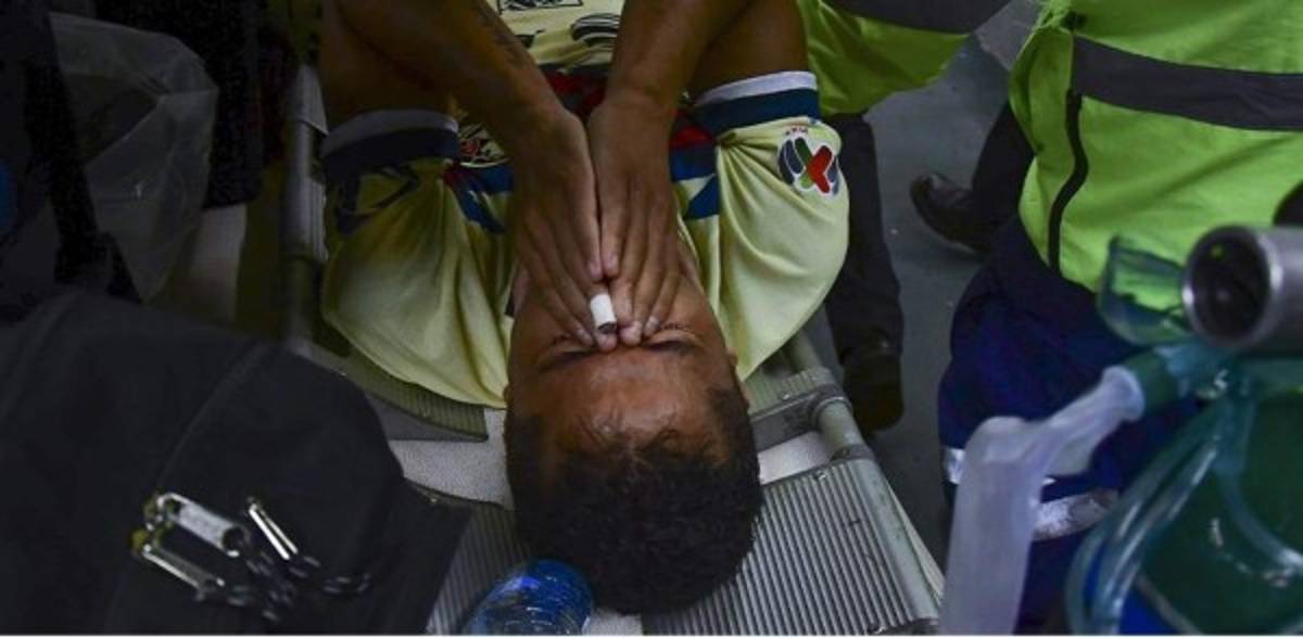 Las impactantes y terroríficas imágenes de la grave lesión de Giovanni dos Santos