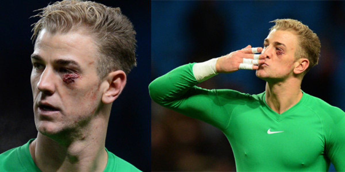 Impactante golpe se llevó Joe Hart en la Premier