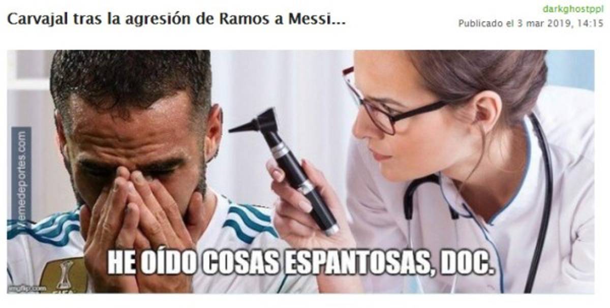 ¡Hasta Shakira! Los memes siguen masacrando al Real Madrid tras perder el Clásico