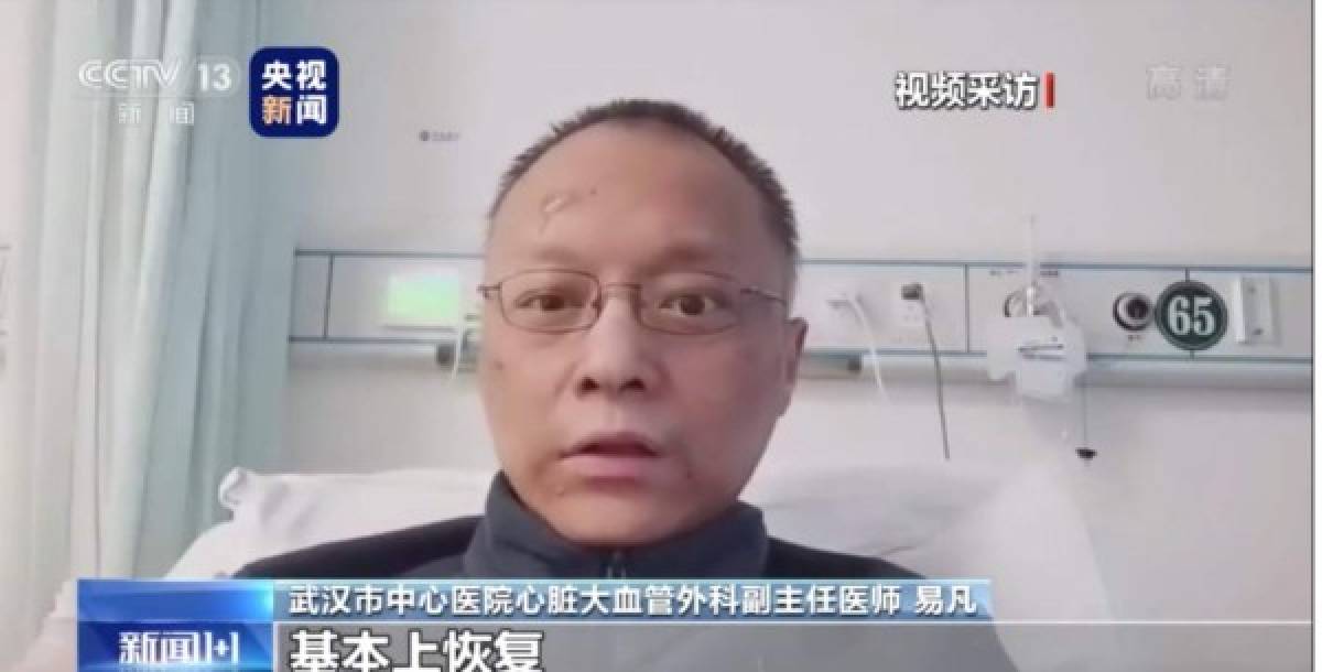 El terrible cambio de piel de dos médicos chinos sobrevivientes del coronavirus en Wuhan