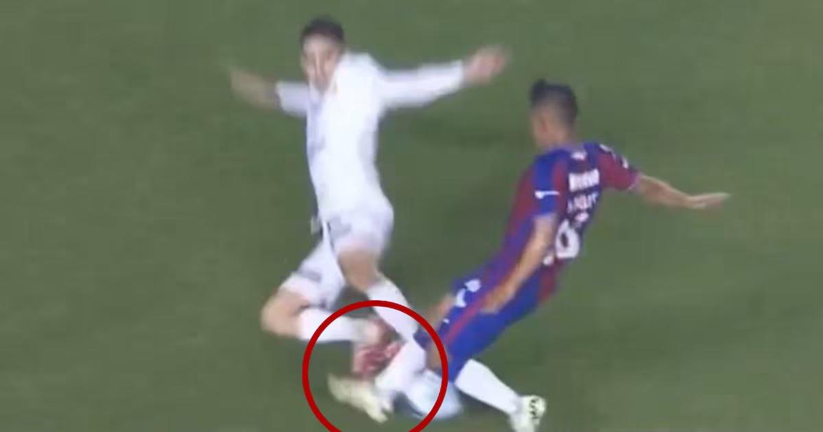 Escalofriante lesión del mexicano Hobbit Bermúdez: así quedó la pierna del jugador y la bronca con el culpable