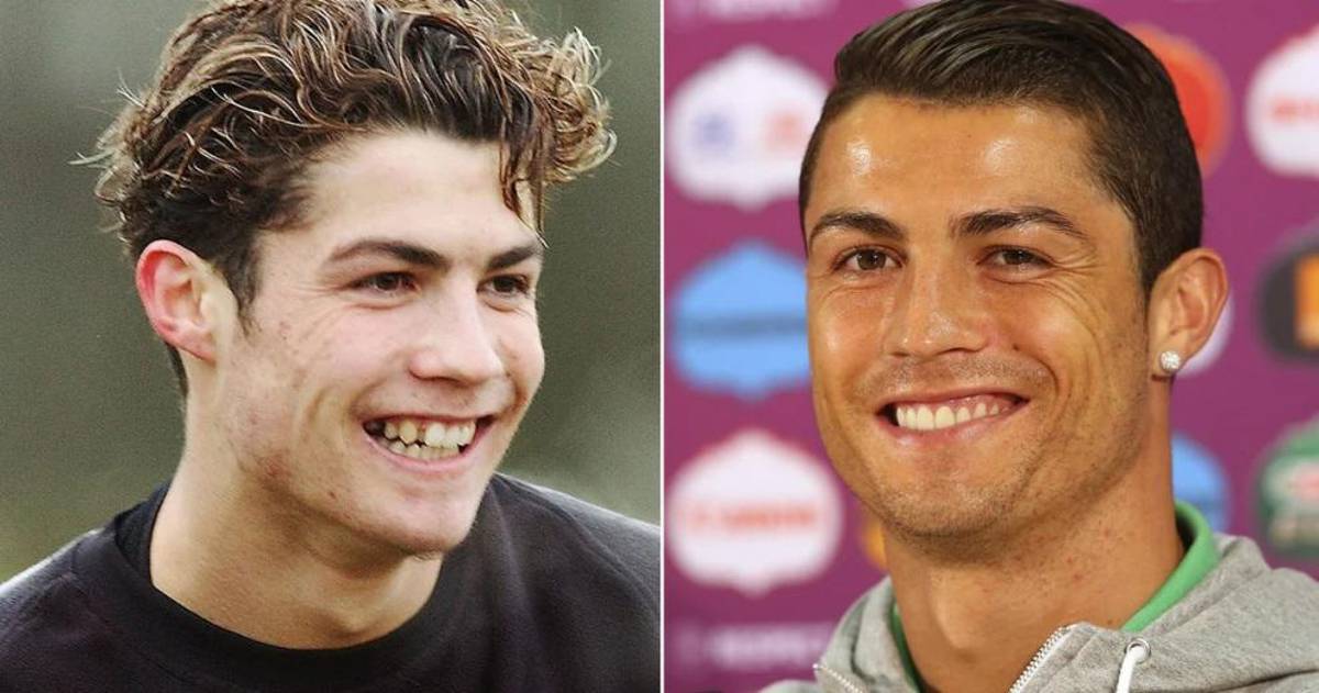 ¿El poder del dinero? Así cambió el rostro de los futbolistas con el paso de los años: Lo de Beckham y Cristiano Ronaldo es increíble