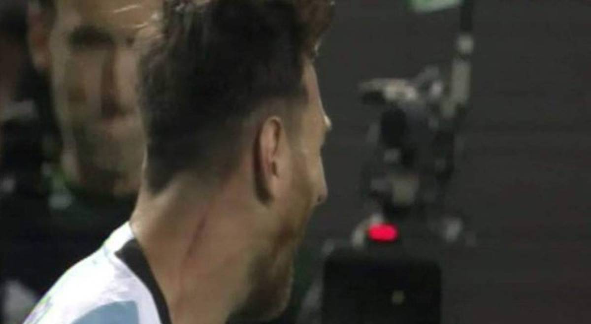 Futbolista panameño marcó el cuello de Messi con sus uñas