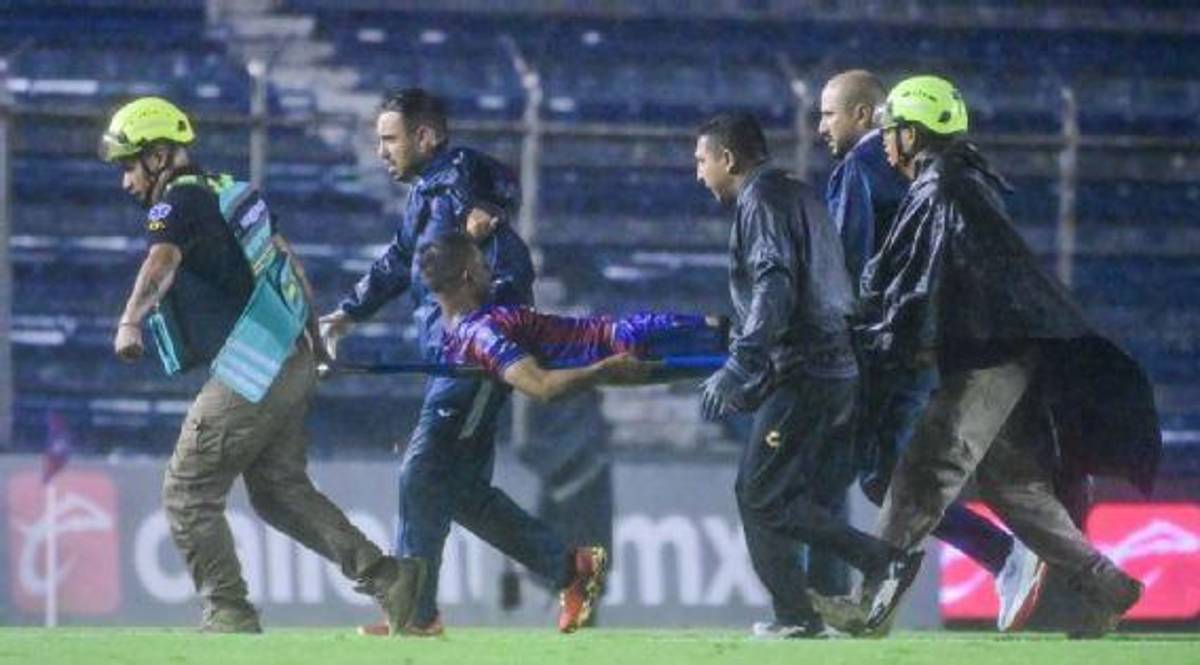 Escalofriante lesión del mexicano Hobbit Bermúdez: así quedó la pierna del jugador y la bronca con el culpable