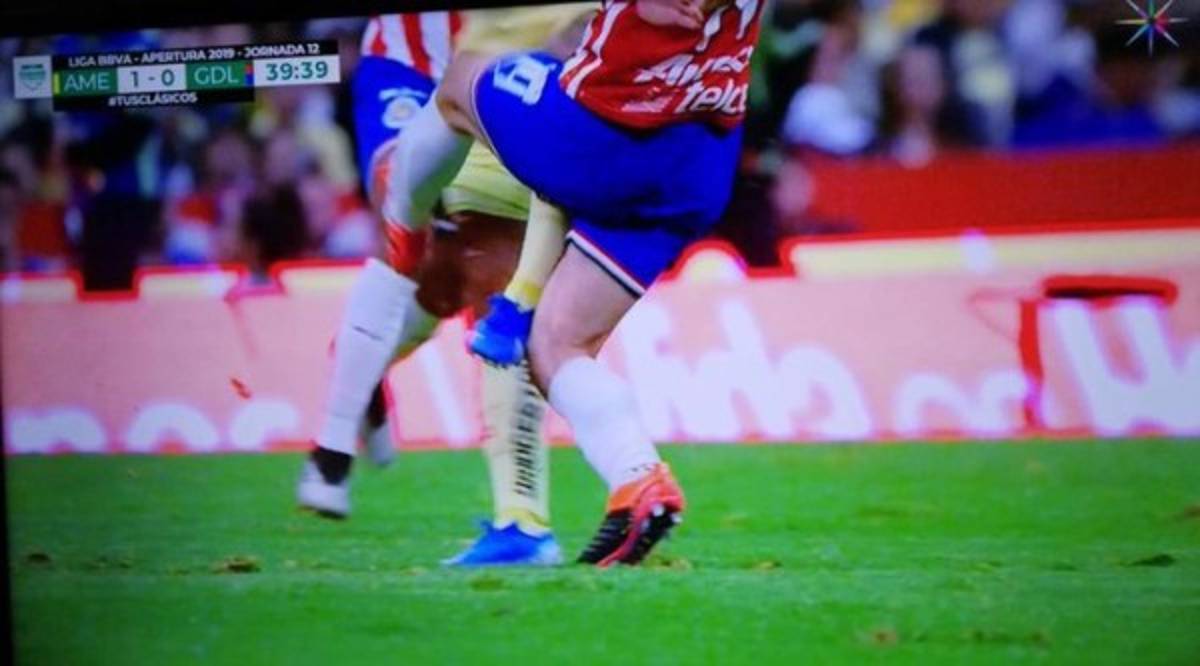 Las impactantes y terroríficas imágenes de la grave lesión de Giovanni dos Santos