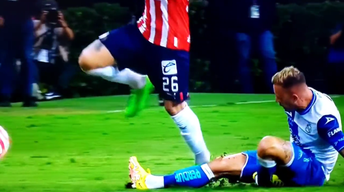 ¡Fuertes imágenes! La espeluznante lesión en la Liga MX: jugador del Puebla se deshace tobillo en desafortunada entrada